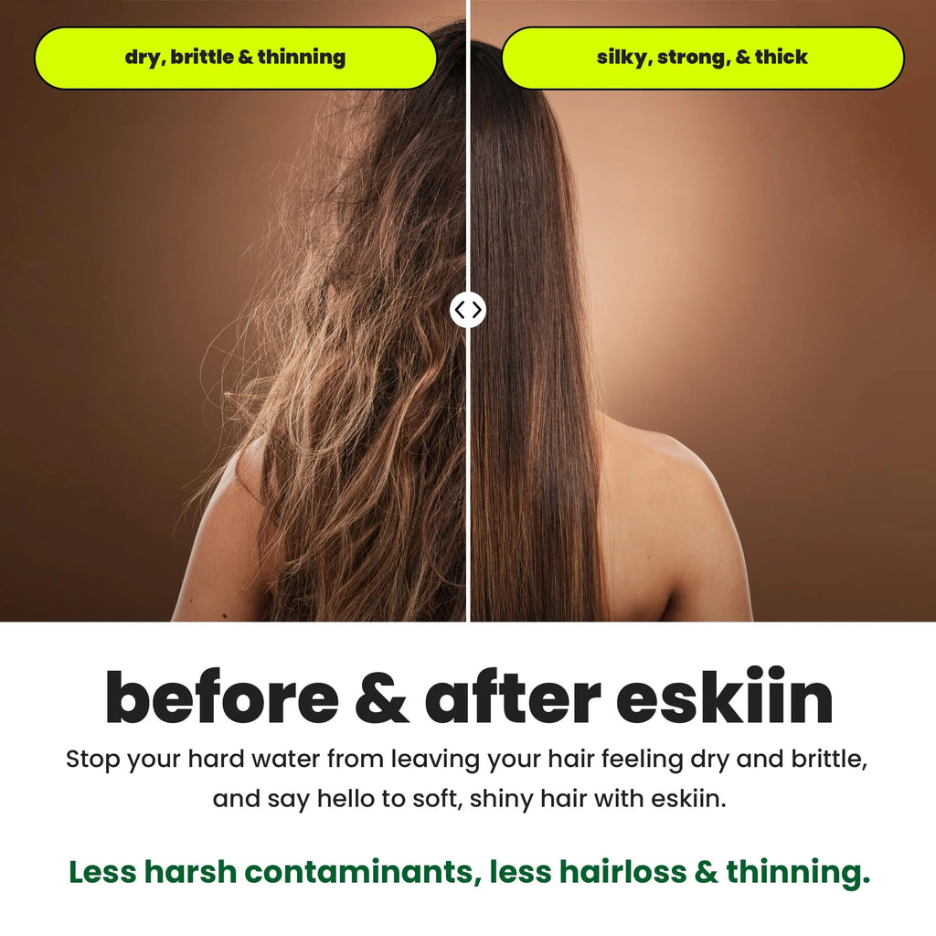 Eskiin Filtered Showerhead With Filters For Healthy Hair  Skin(Chrome)
